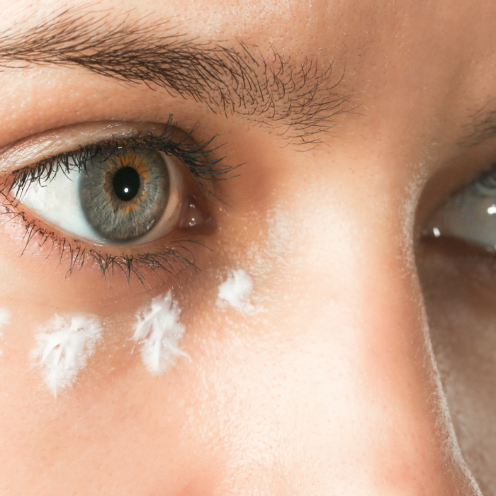 Close up of woman's eyes with dots of white eye cream under one eye.