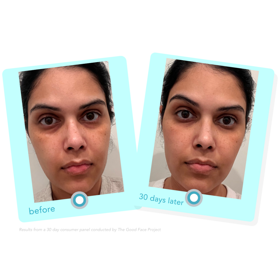 8 Simple Ways to Improve Congested Skin and Clogged Pores — Graydon ...