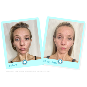 8 Simple Ways to Improve Congested Skin and Clogged Pores — Graydon ...