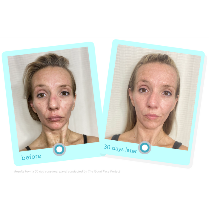 8 Simple Ways to Improve Congested Skin and Clogged Pores — Graydon ...